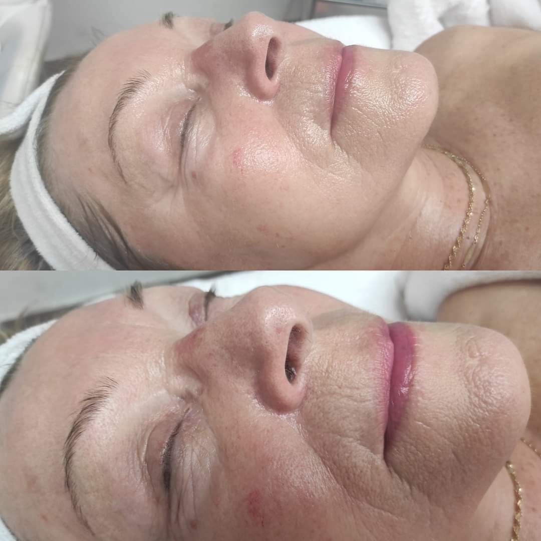 Masáže v Salon Rose